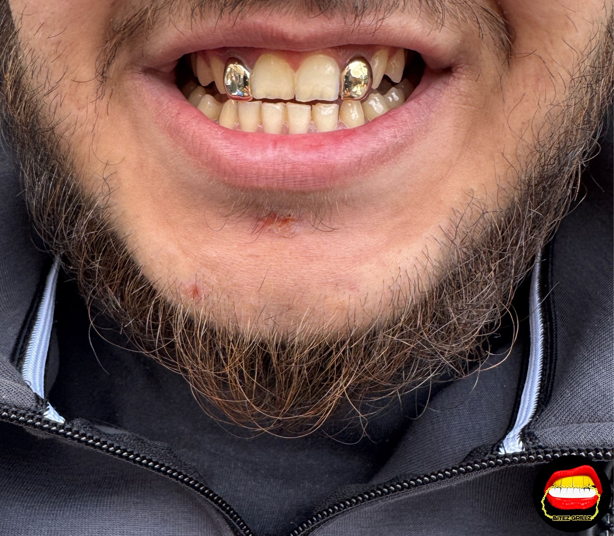 Lateral - Lateral - Bitez Grillz
