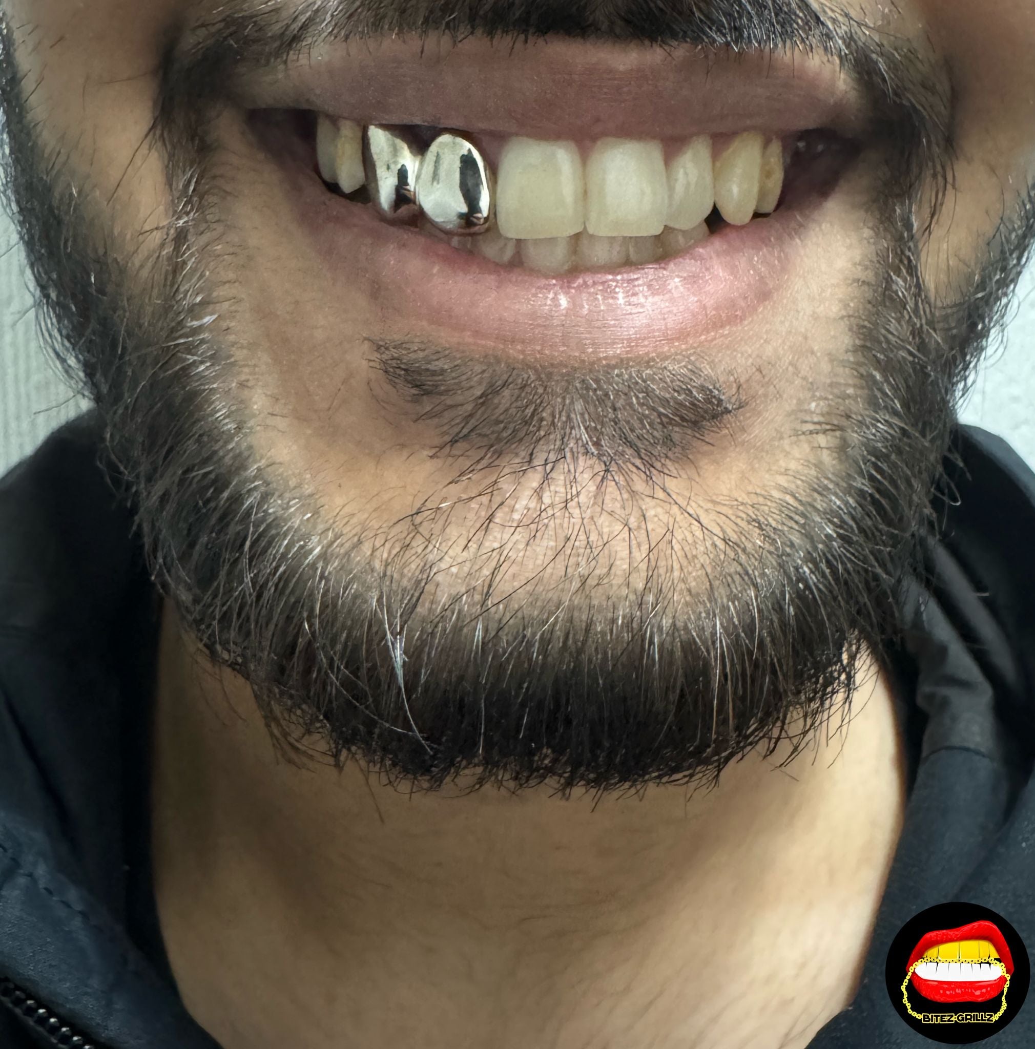 Lateral & Canine - Bitez Grillz
