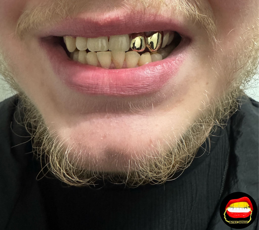 Lateral & Canine - Bitez Grillz