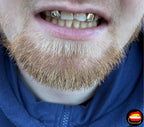 Lateral - Lateral - Bitez Grillz