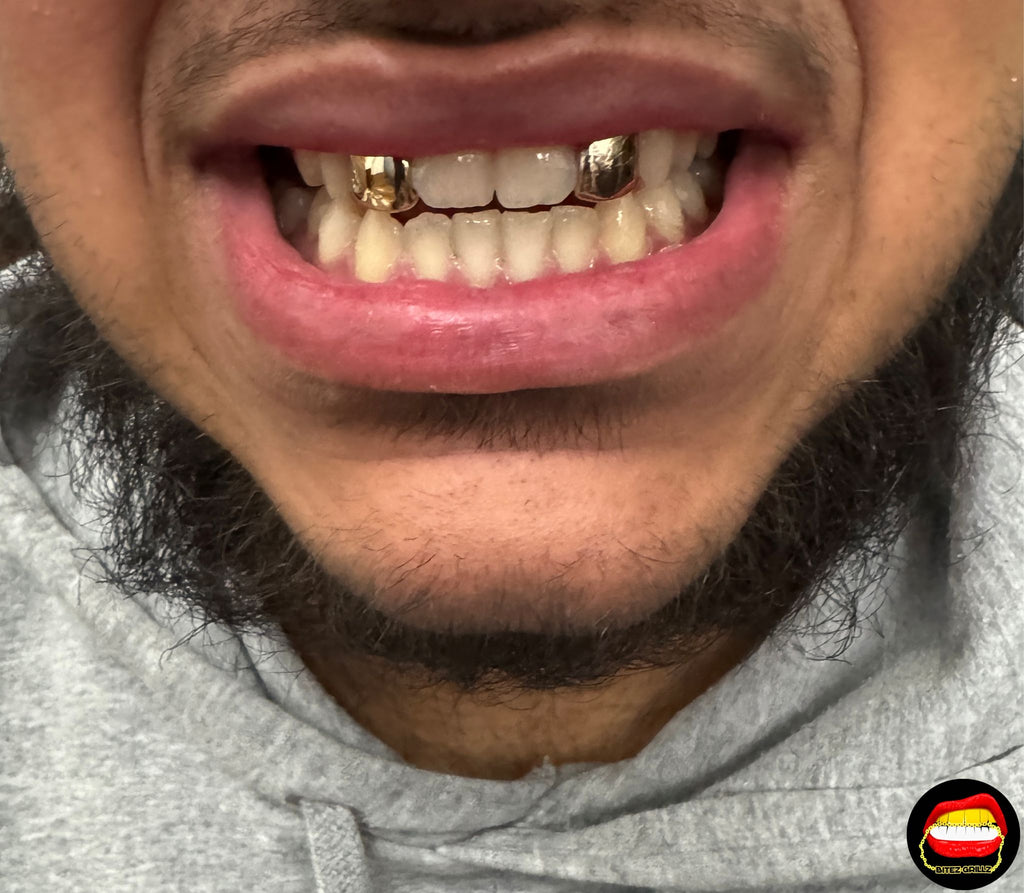 Lateral - Lateral - Bitez Grillz