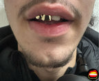 Front Tooth & Lateral - Bitez Grillz
