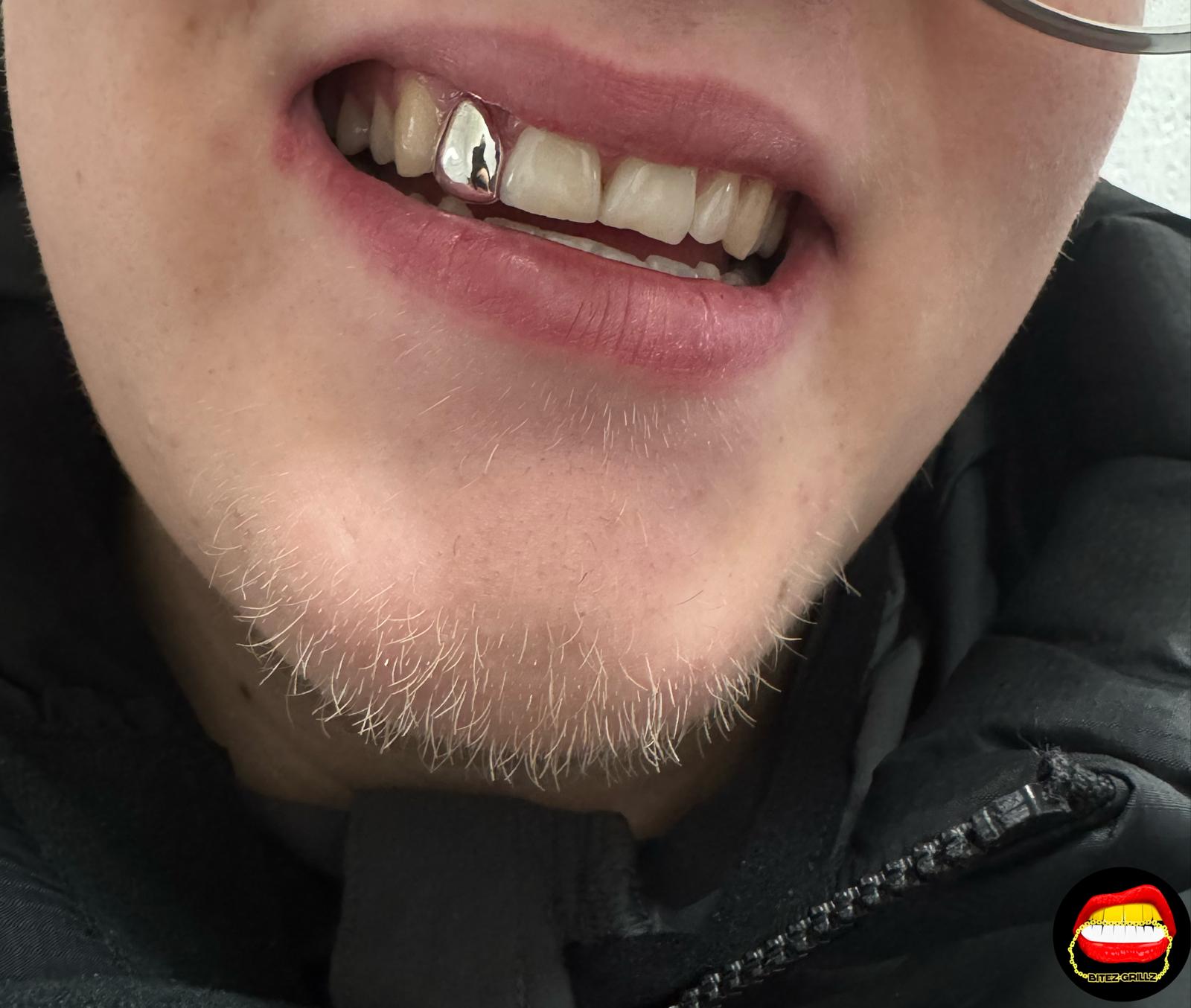 Lateral - Bitez Grillz