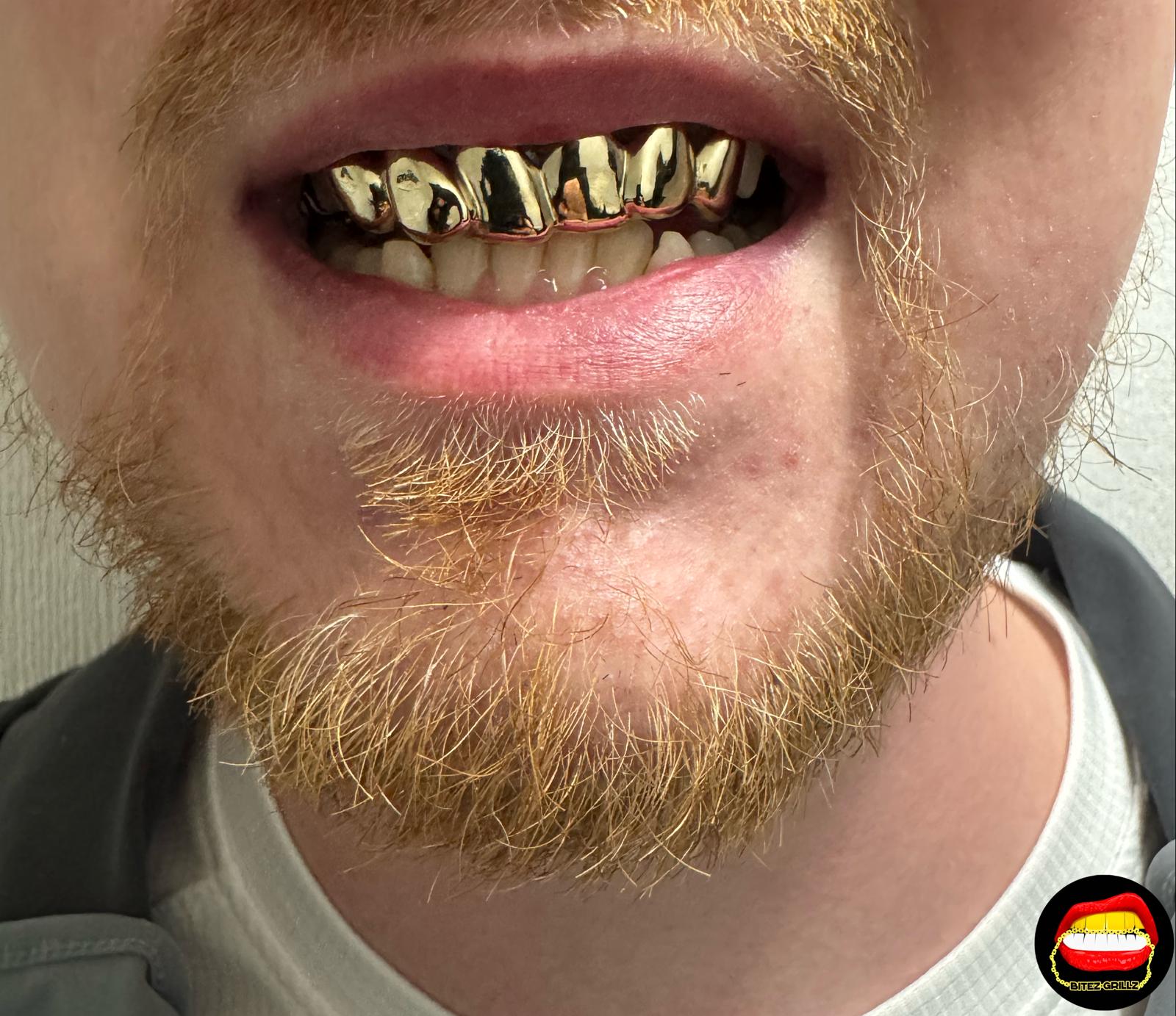 Top 6 - Bitez Grillz