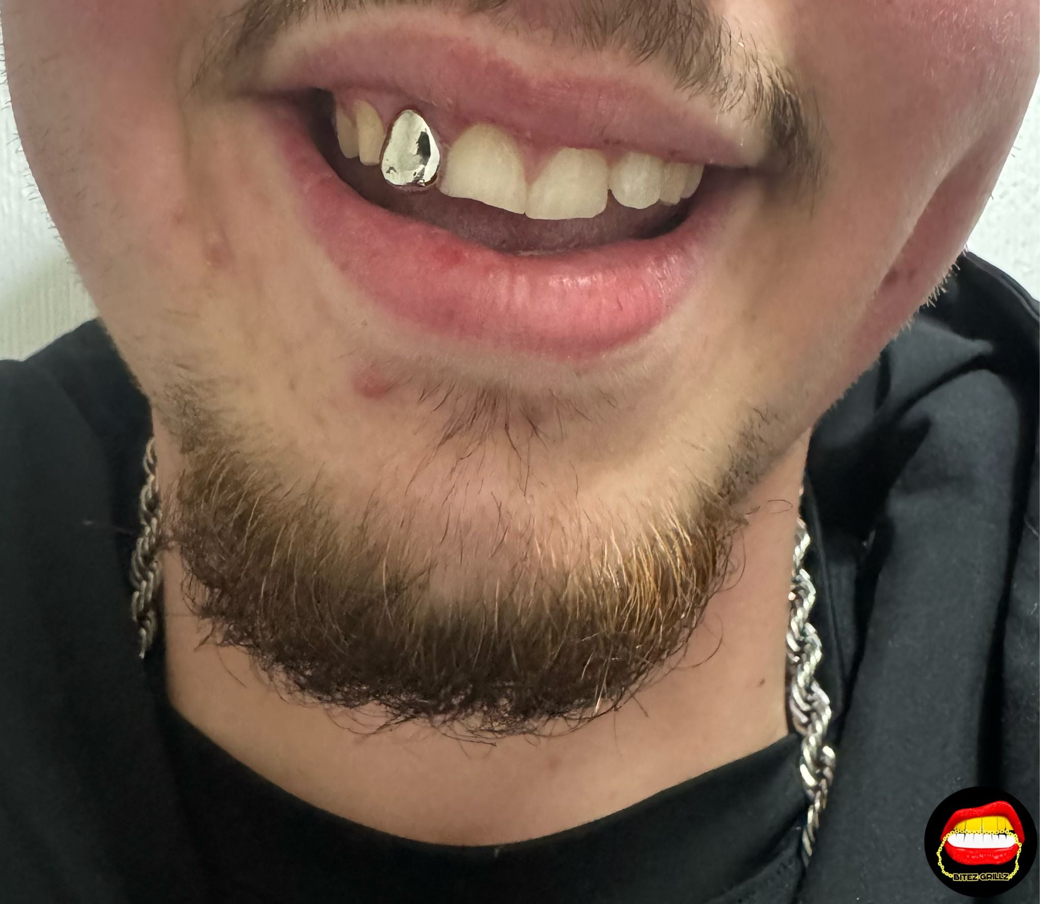 Lateral - Bitez Grillz
