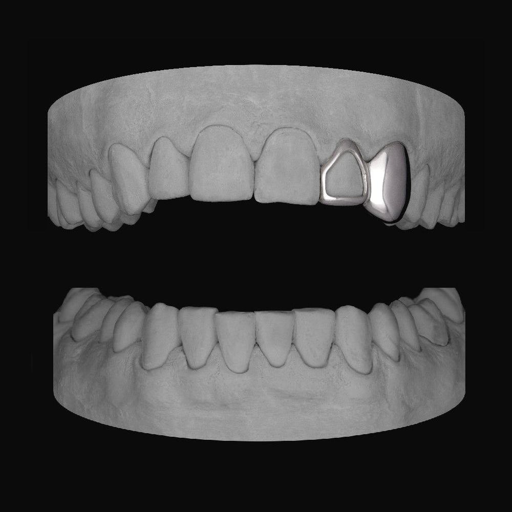 Window Lateral & Canine - Bitez Grillz