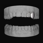 Window Lateral & Canine - Bitez Grillz