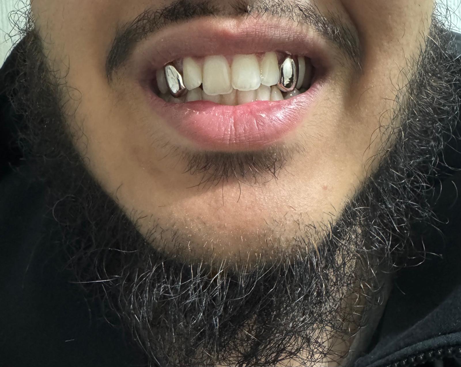 Canine - Canine - Bitez Grillz